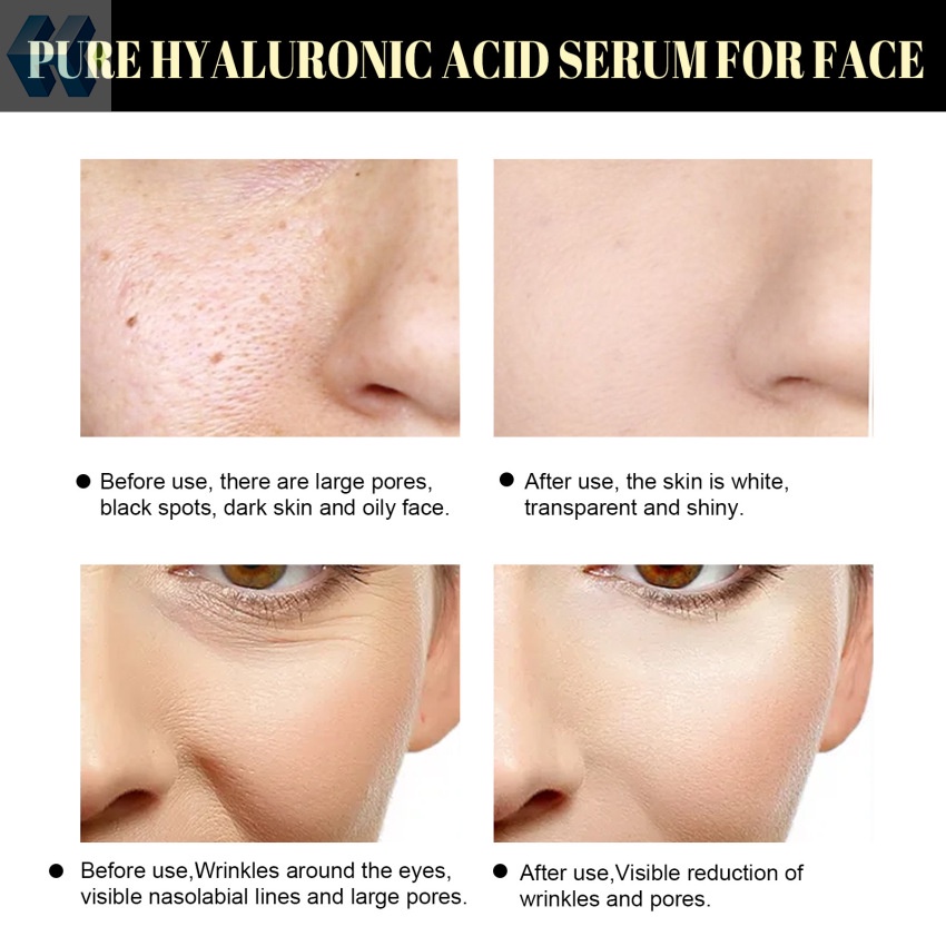 Tinh Chất Protein Nâng Da Chống Nếp Nhăn Làm Săn Chắc Và Sáng Da