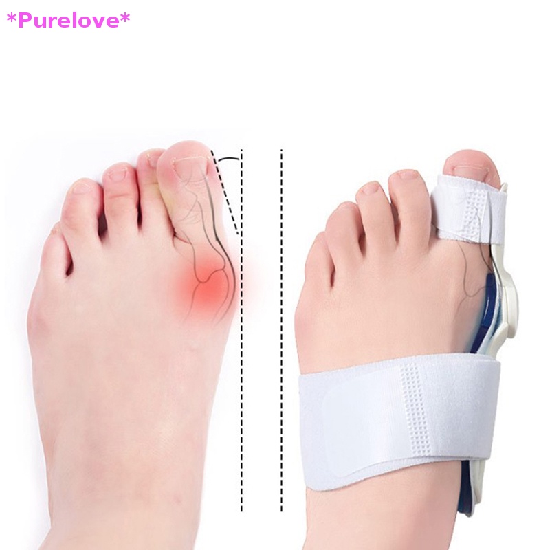 Đai Nẹp Định Hình Ngón Chân Cái Giảm Đau Tiện Dụng Mới