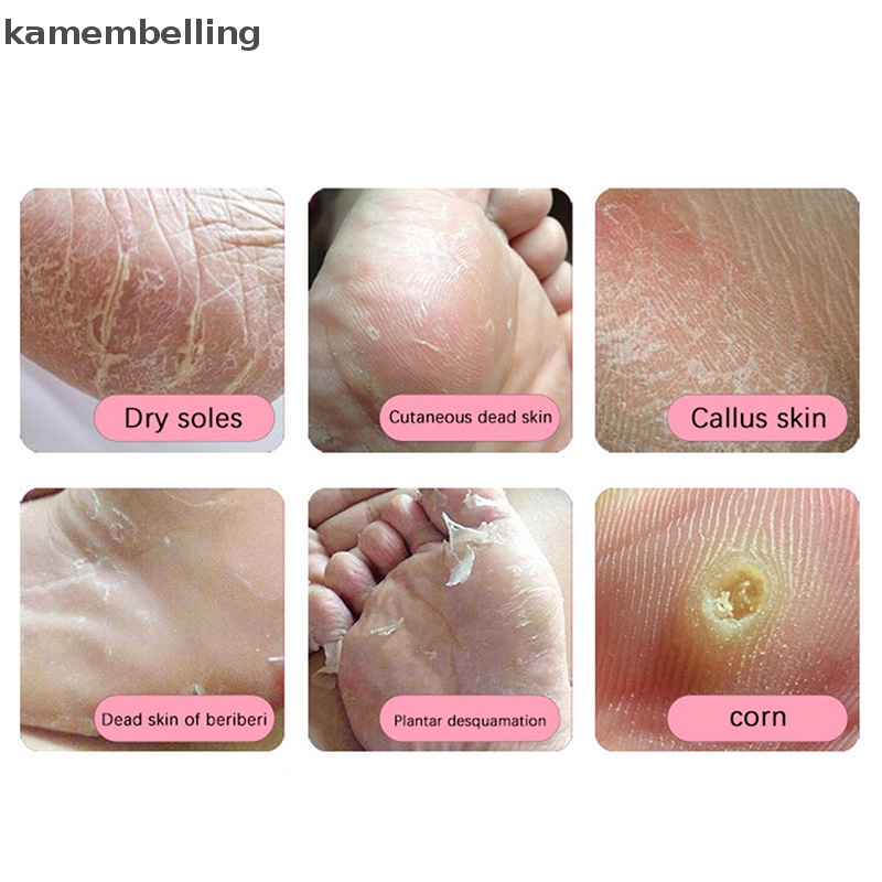 Dụng Cụ Dũa Loại Bỏ Da Chết Cho Chân Bằng Thép Không Gỉ Cứng