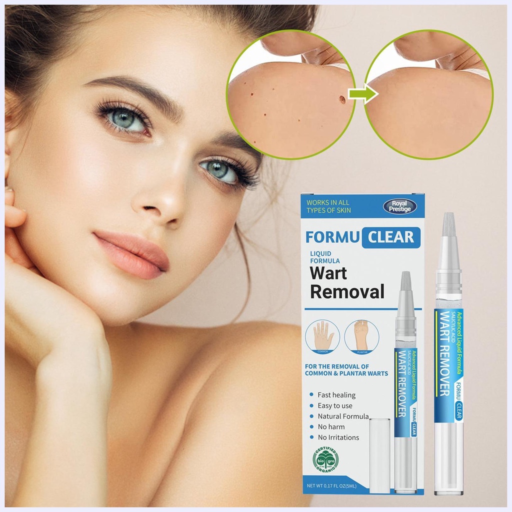 Bút Xóa Nốt Ruồi Và Mụn Thịt Dư Thông Dụng