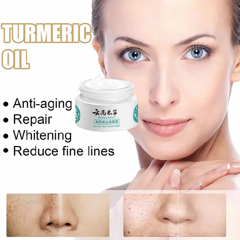 Whitening Spot Freckle Cream Dark Spots Corrector Melasma Remover for Face Skin