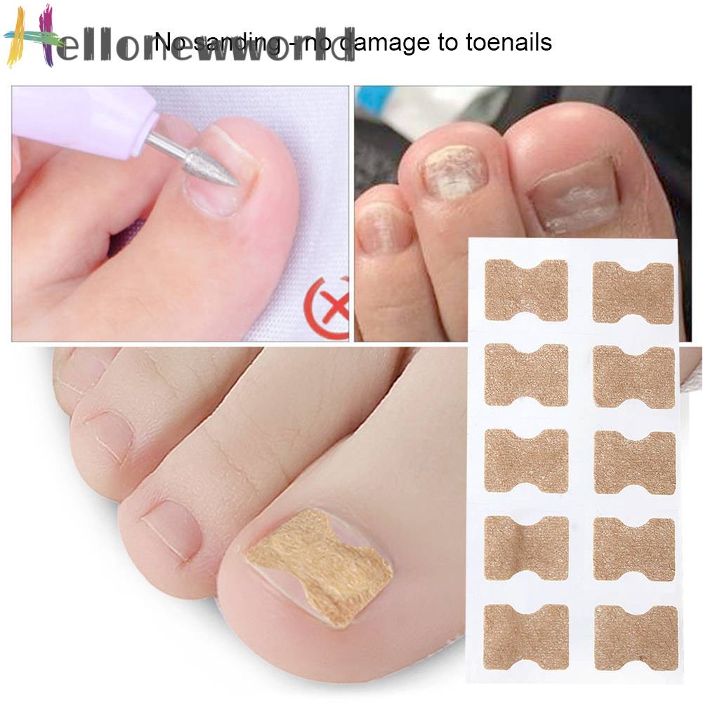 Set 10 Miếng Dán Chỉnh Sửa Móng Chân Tiện Dụng