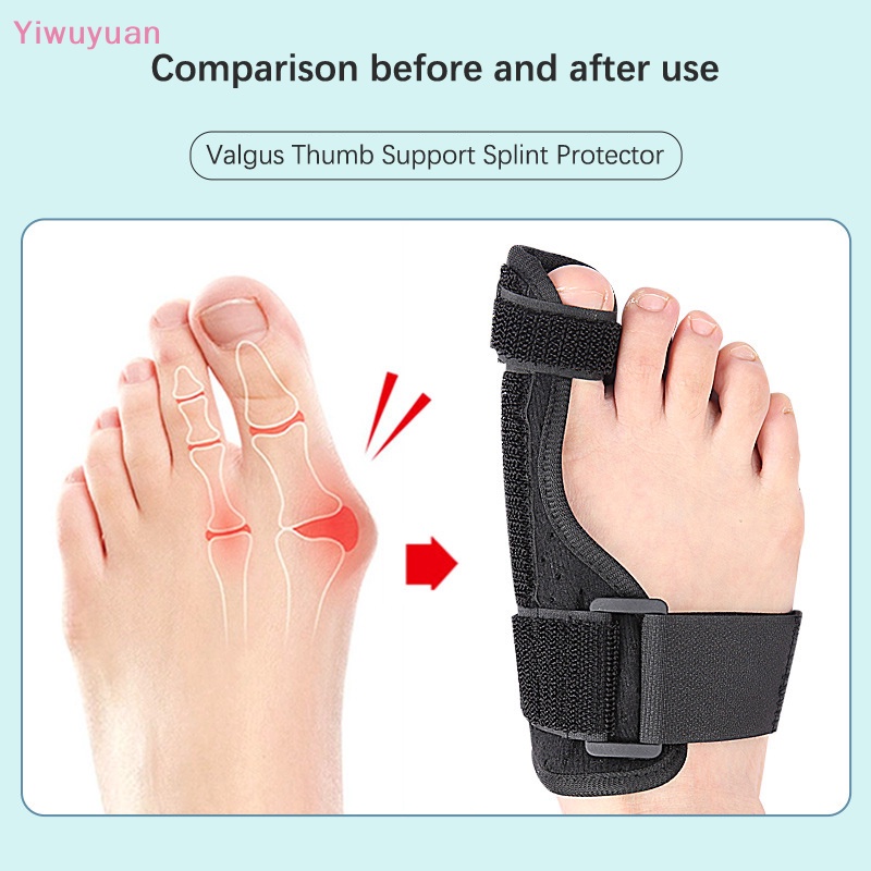 1 Dụng Cụ Nẹp Chỉnh Hình Ngón Chân Cái Chăm Sóc Chân Mềm Mại