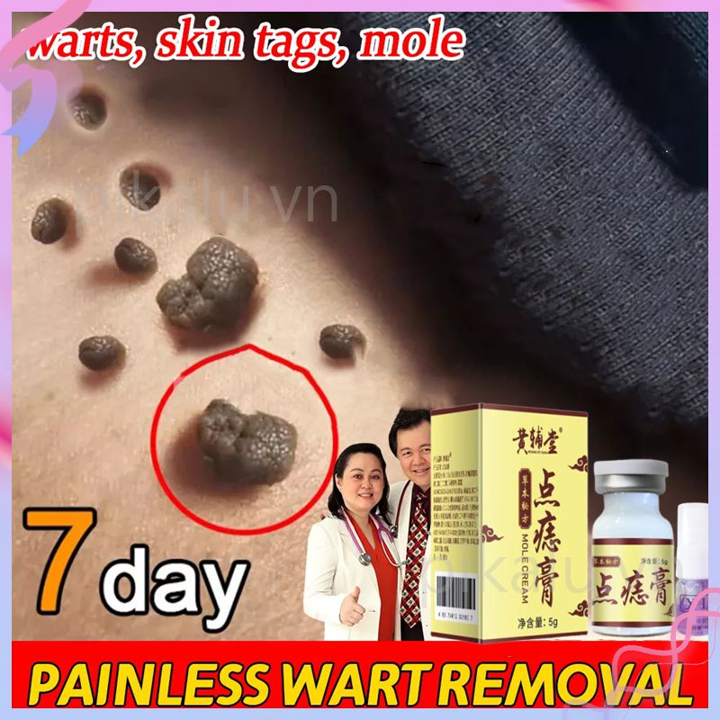 Mụn cóc nốt ruồi mụn cóc và hạt cholesterol Wars Remover Cream Skin Tag Removal Mole Remover Cream -pikalu