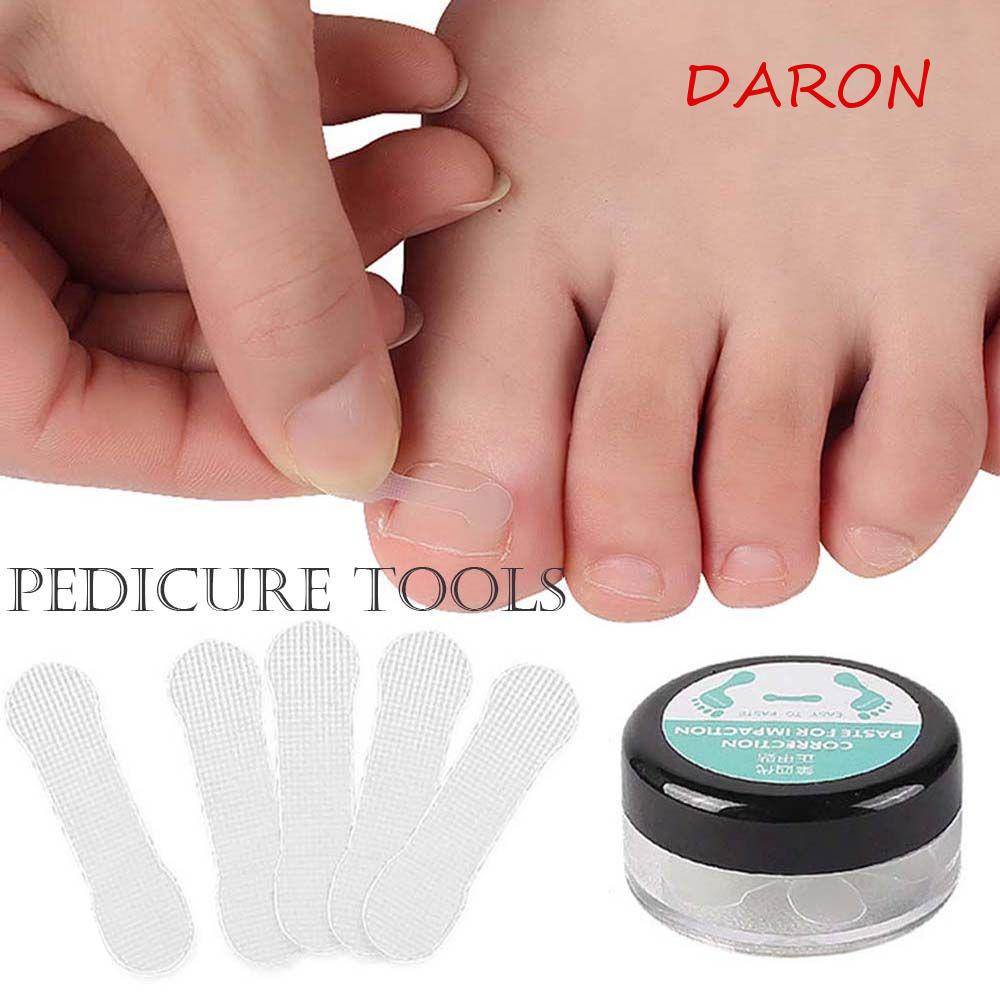 Miếng Dán Chỉnh Hình Móng Chân Mọc Ngược Hữu Dụng DARON Ingrown