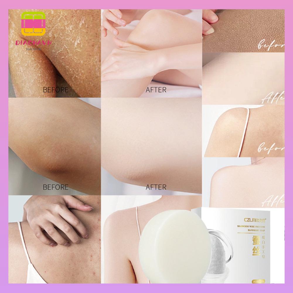 DIACHAVN Xà Phòng Tẩy Trắng Da Toàn Thân Loại Bỏ Đốm Đen Trên Đầu Gối Cho Nữ