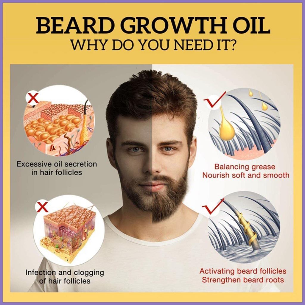 Dầu Xả Kích Thích Mọc Râu 30ml Dưỡng Ẩm Làm Mềm Râu Tự Nhiên nota2vn Cho Nam