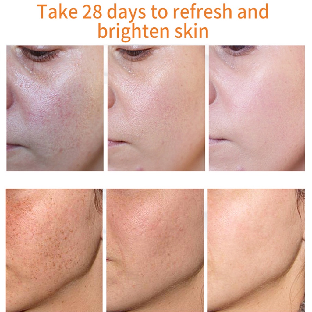 Kem Làm Trắng Da 20g Giúp Xóa Mờ Vết Thâm Hiệu Quả