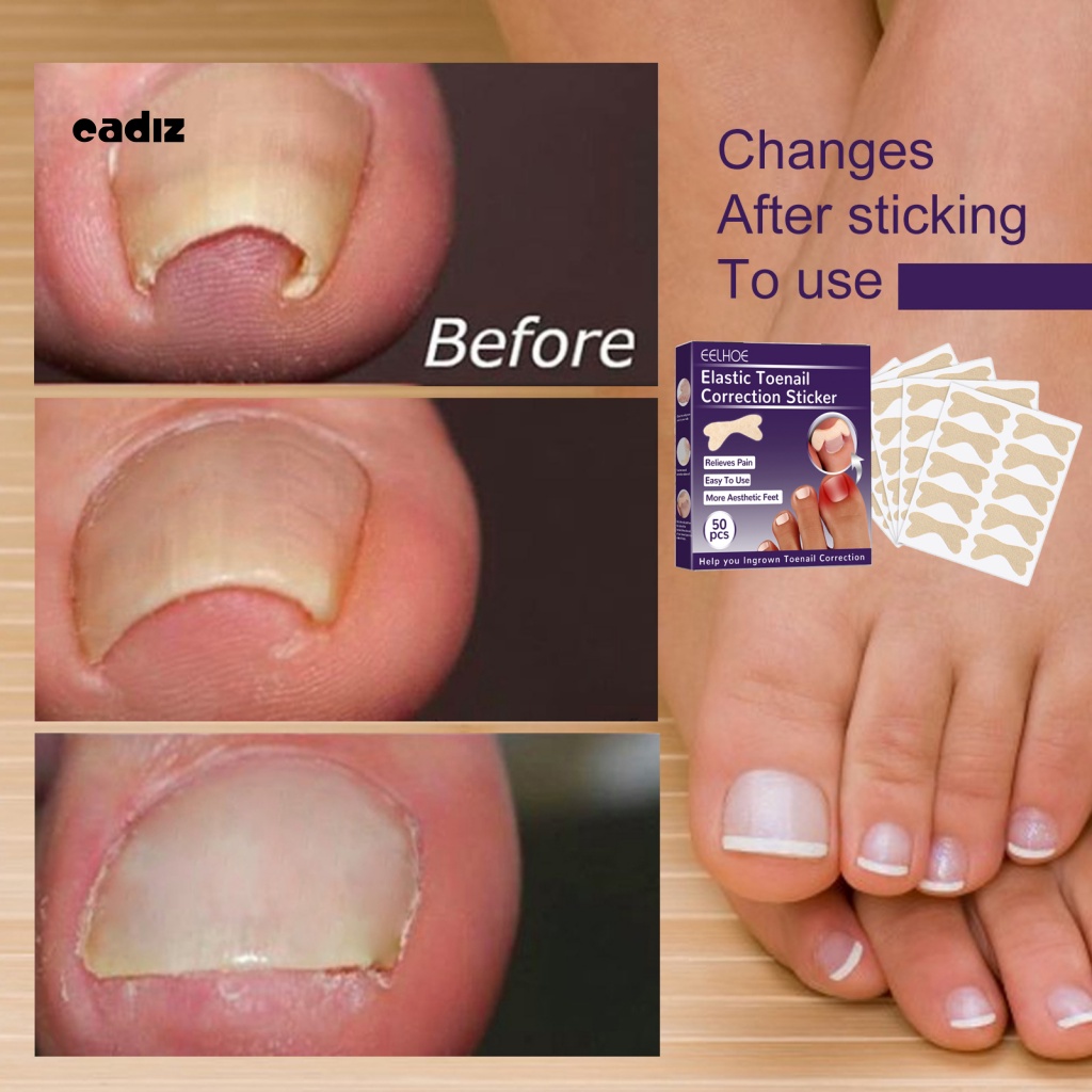 Bộ 50 Miếng Dán Móng Chân Thoáng Khí Hình Bướm Cho Nam