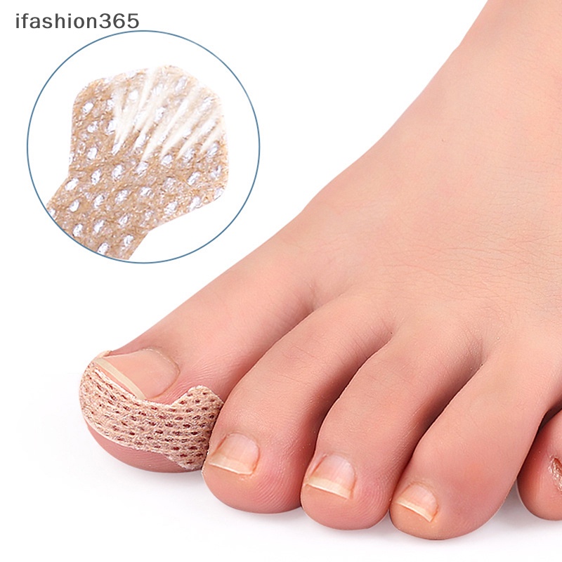 Set 4 / 10 Miếng Dán Chỉnh Hình Móng Chân Mọc Ngược ifashion365