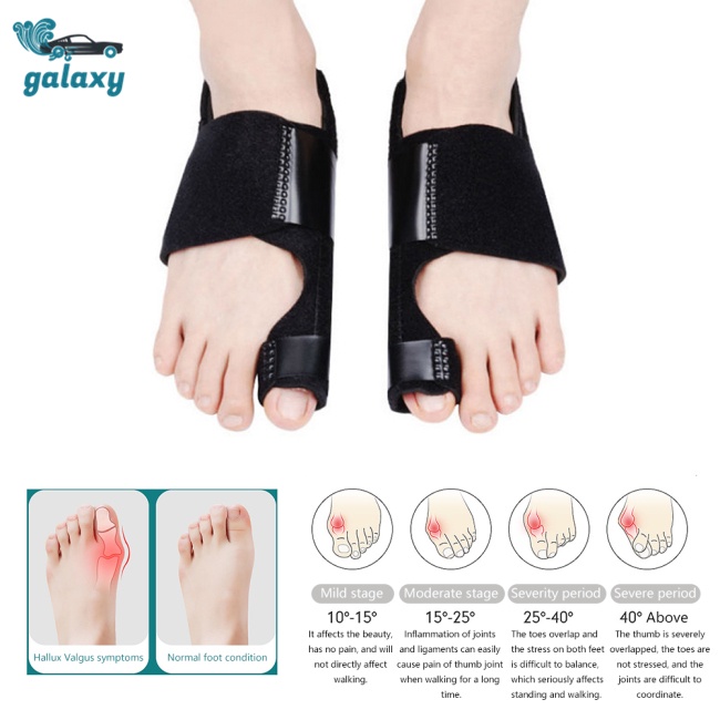 Galaxy 1 Cặp Dụng Cụ Chỉnh Hình Ngón Chân Cái