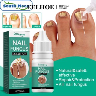 Tinh chất dưỡng móng Eelhoe làm dày móng chân vàng nấm móng mọc ngược làm sáng dưỡng chất phong phú 10ml