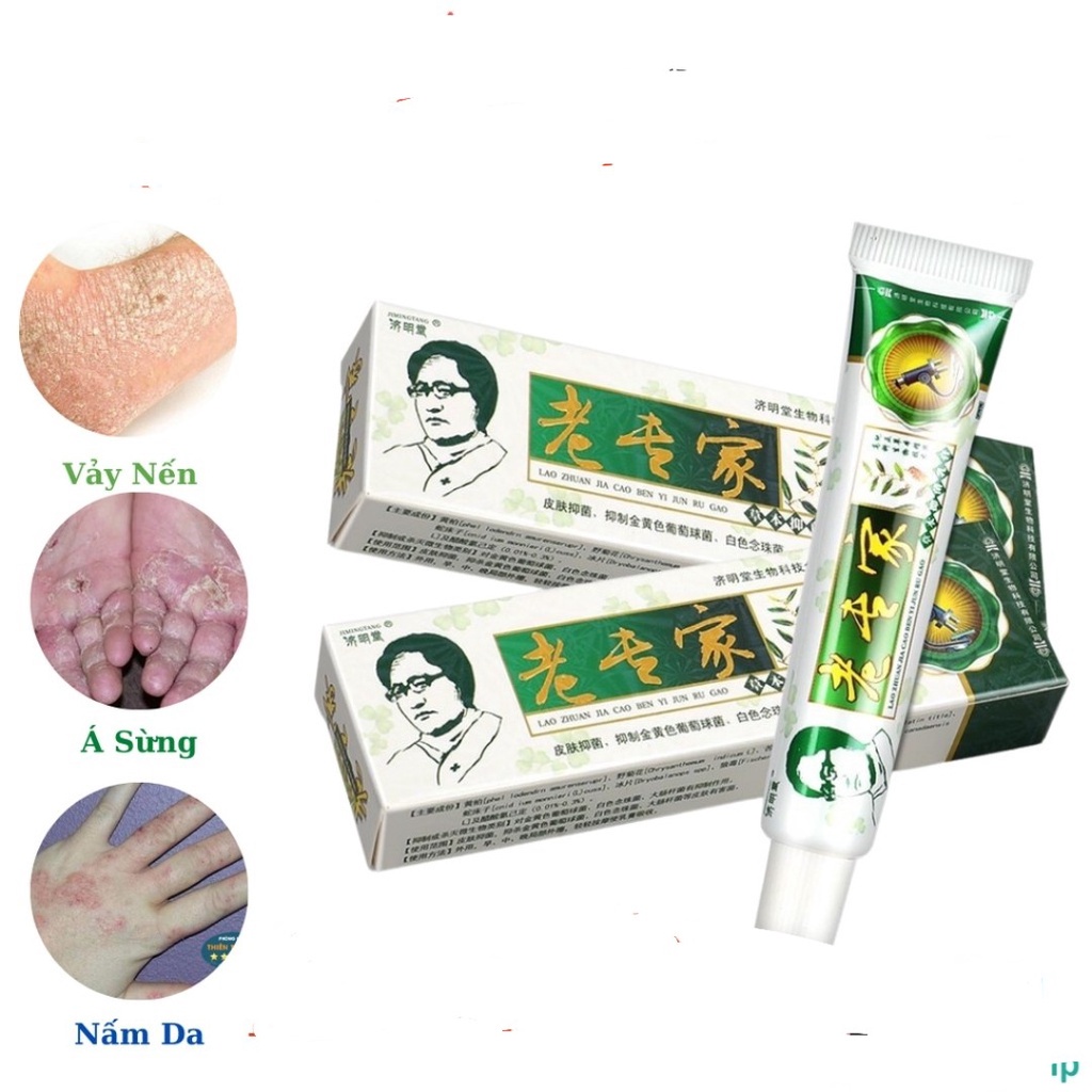 Kem Bôi Thảo Dược Á Sừng Nấm Ghẻ Ngứa Xanh Lá 15g