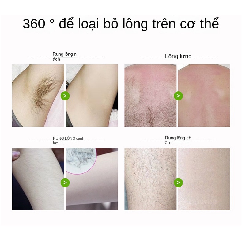 Kem Tẩy Lông Toàn Thân Không Gây Kích Ứng Nhanh Chóng Cho Nam Và Nữ Tda434