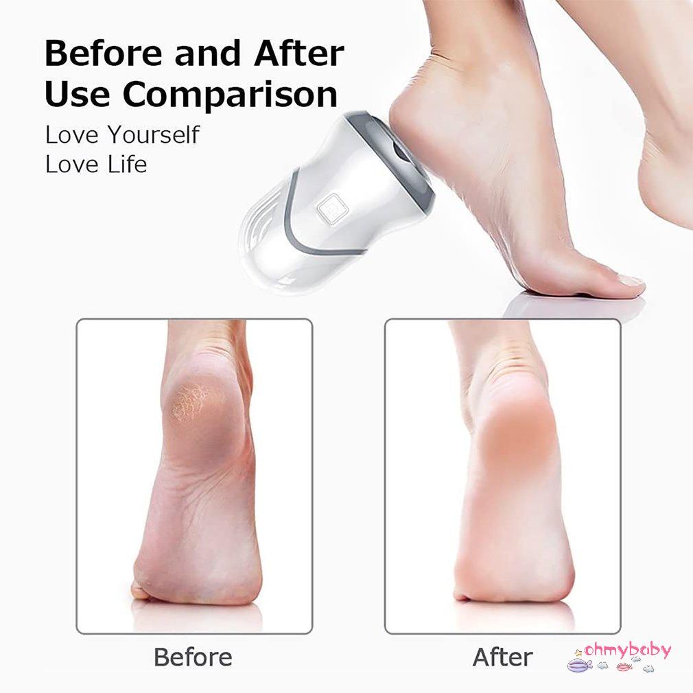 [Ready] Máy mài chân với 5 cặp đầu hút không điện cầm tay tẩy tế bào chết [Z/15]