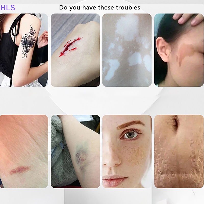 Bộ 8 Miếng Dán Che Khuyết Điểm Hình Xăm Nhỏ Gọn Chống Nước