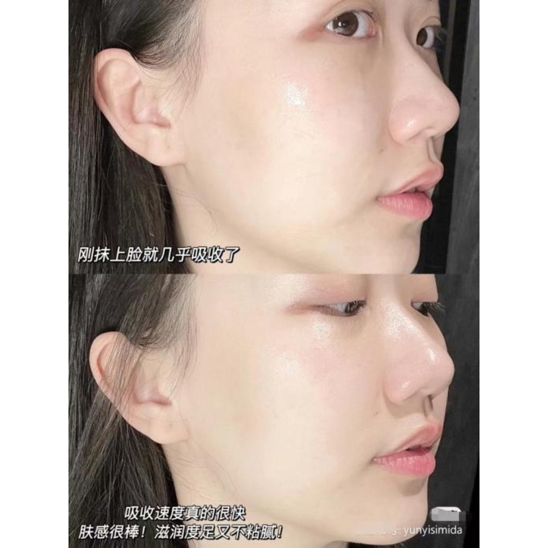 Tinh Chất Shiseido Red Kidney Giúp Dưỡng Ẩm Và Làm Sáng Da 100ml