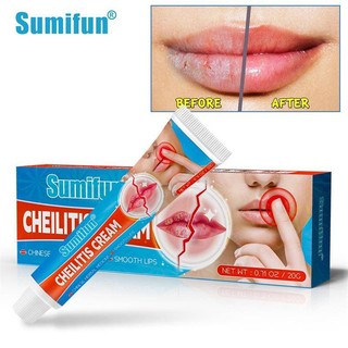Kem dưỡng ẩm môi 20g không gây kích ứng không gây nhờn
