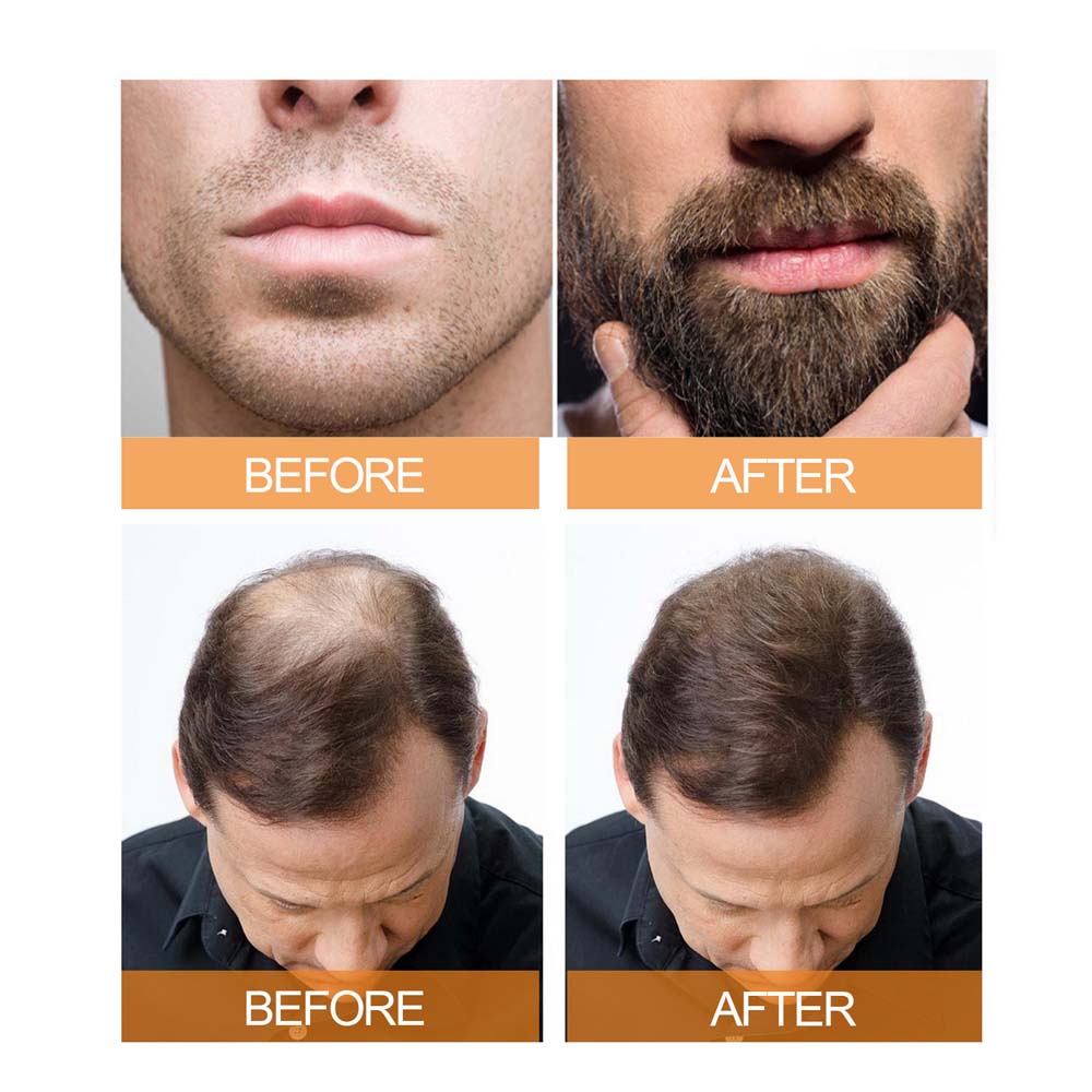 Jayswing Hair Growth spray Beard and Hair Dense Care Fluid 100ml