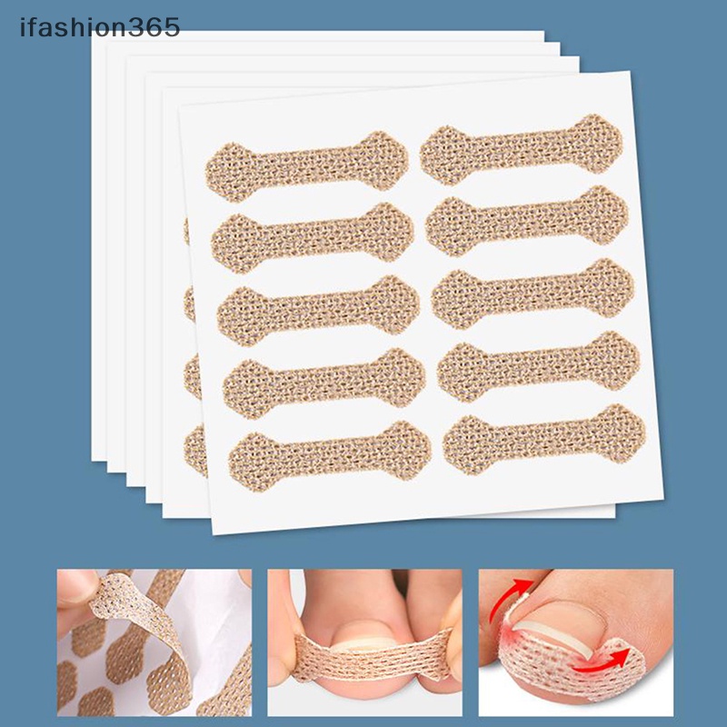 Set 4 / 10 Miếng Dán Chỉnh Hình Móng Chân Mọc Ngược ifashion365