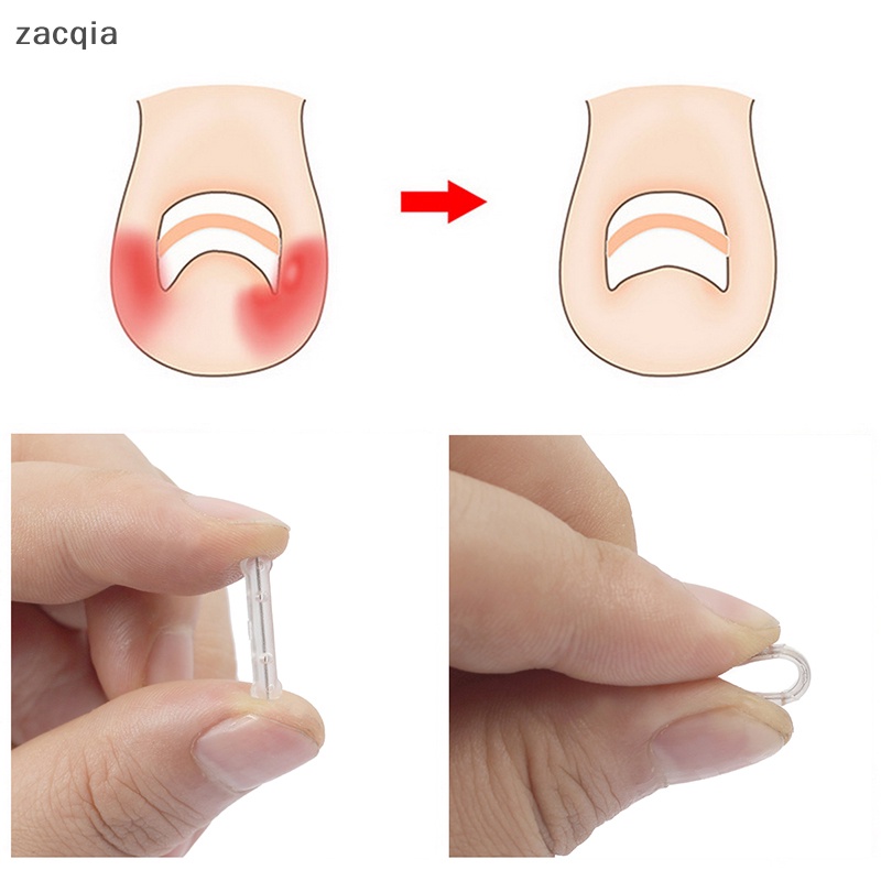 Set 10 Miếng Dán Chỉnh Sửa Móng Chân 13-20mm Tiện Dụng