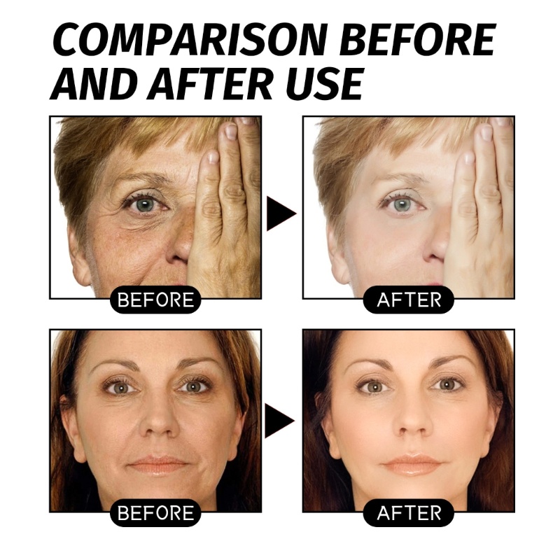 Tinh Chất Hyaluronic Acid Vàng 100g Giúp Làm Mờ Nếp Nhăn Và Dưỡng Ẩm Cao Cấp