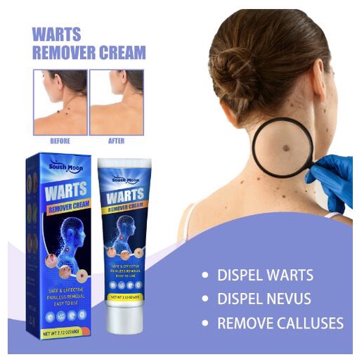 Tuýp Kem 60g Trị Mụn Trứng Cá Làm Mềm Da Chân Tay An Toàn