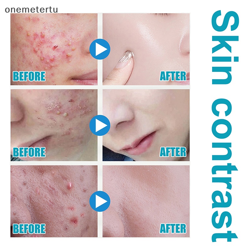 Onemetertu Khẩu Trang Chống Tia Uv Thoáng Khí Thoải Mái Dùng Ngoài Trời Vào Mùa Hè