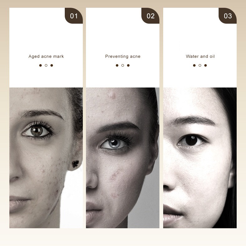 Tinh Chất Salicylic Acid Hỗ trợ giảm mụn Làm Sáng Da Cải Thiện Tình Trạng Thô Và Dull Chăm Sóc Da Mặt 30ml