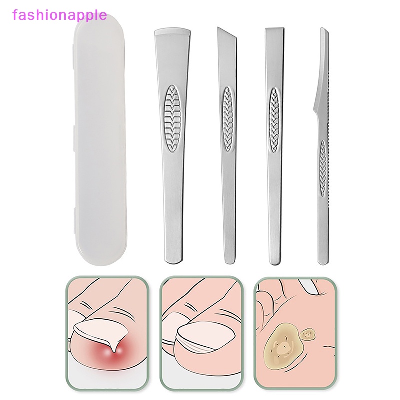 Bộ 3 / 4 Dụng Cụ Chăm Sóc Da Chân Loại Bỏ Vết Chai Sần Tiện Dụng