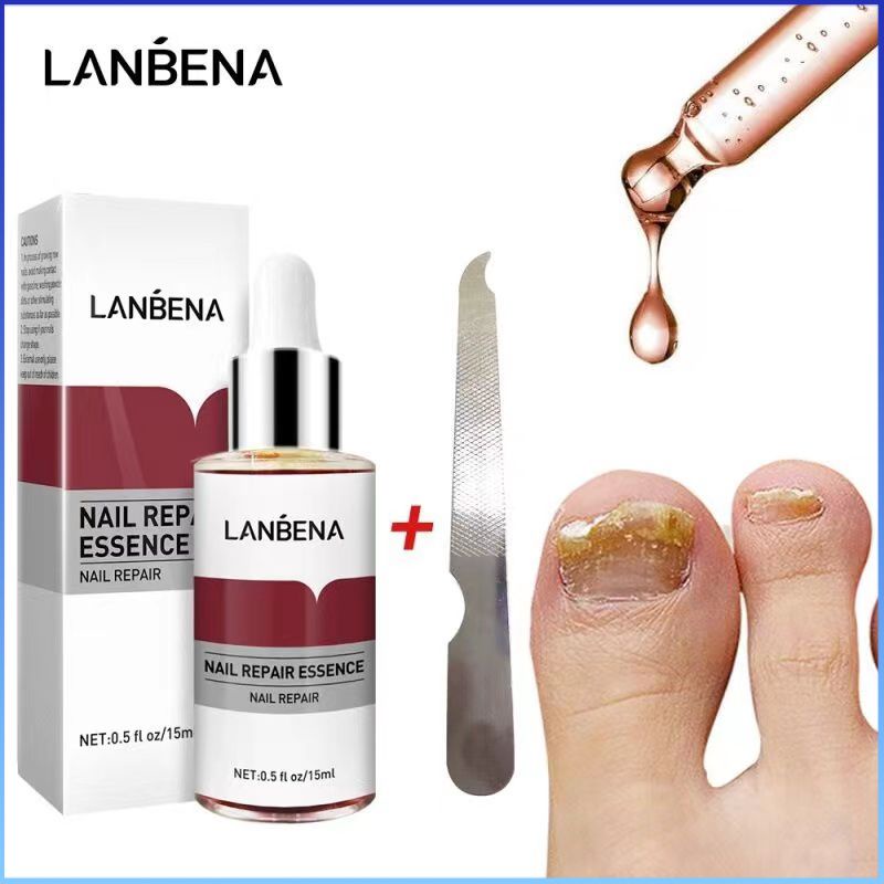 ⚡⚡COD Tinh Chất Sửa Móng Lanbena Trị Nấm Móng Nấm Móng Paronychia Serum Dưỡng Ngón Chân Dưỡng Sáng Chống Nhiễm Trùng Dưỡng Da Tay Chân