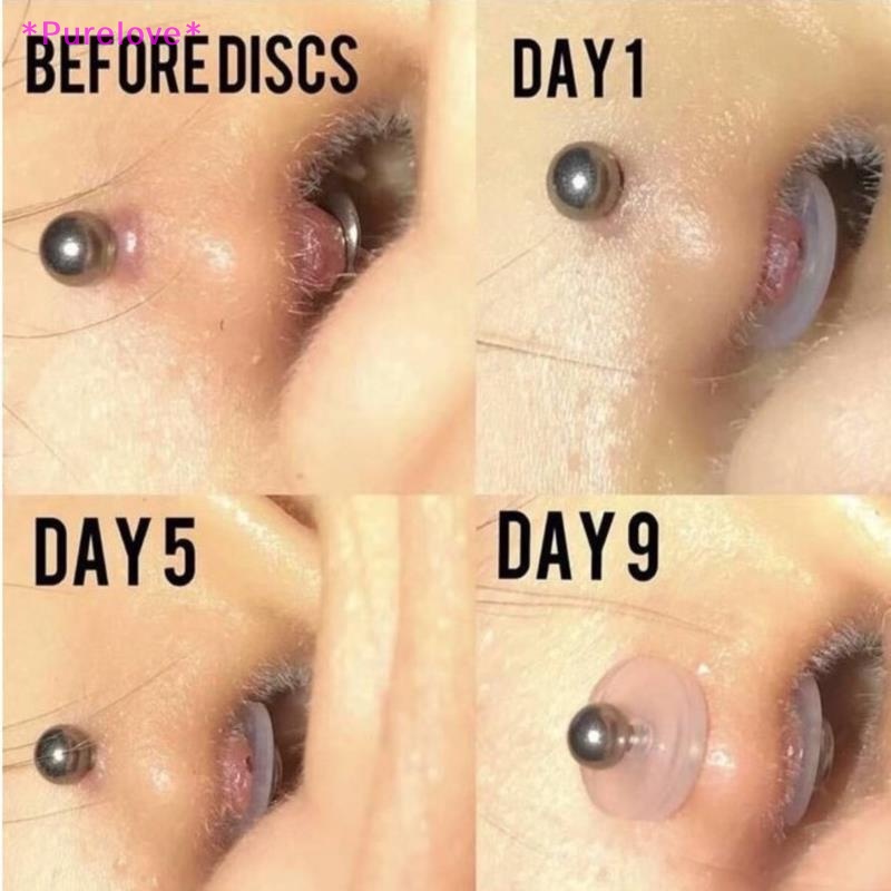 Set 10 Đĩa Đệm Mũi Chống Bệnh Dịch Tiện Dụng Mới