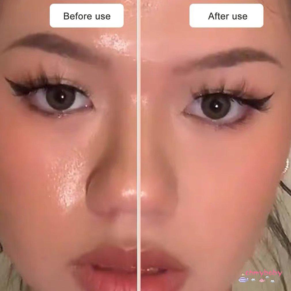 [Ready] Con Lăn Thấm Hút Da Mặt Đá Núi Lửa Loại Bỏ Vết Thâm Vùng Chữ T Thanh Bóng Chăm Sóc Mùa Hè [Z/15]