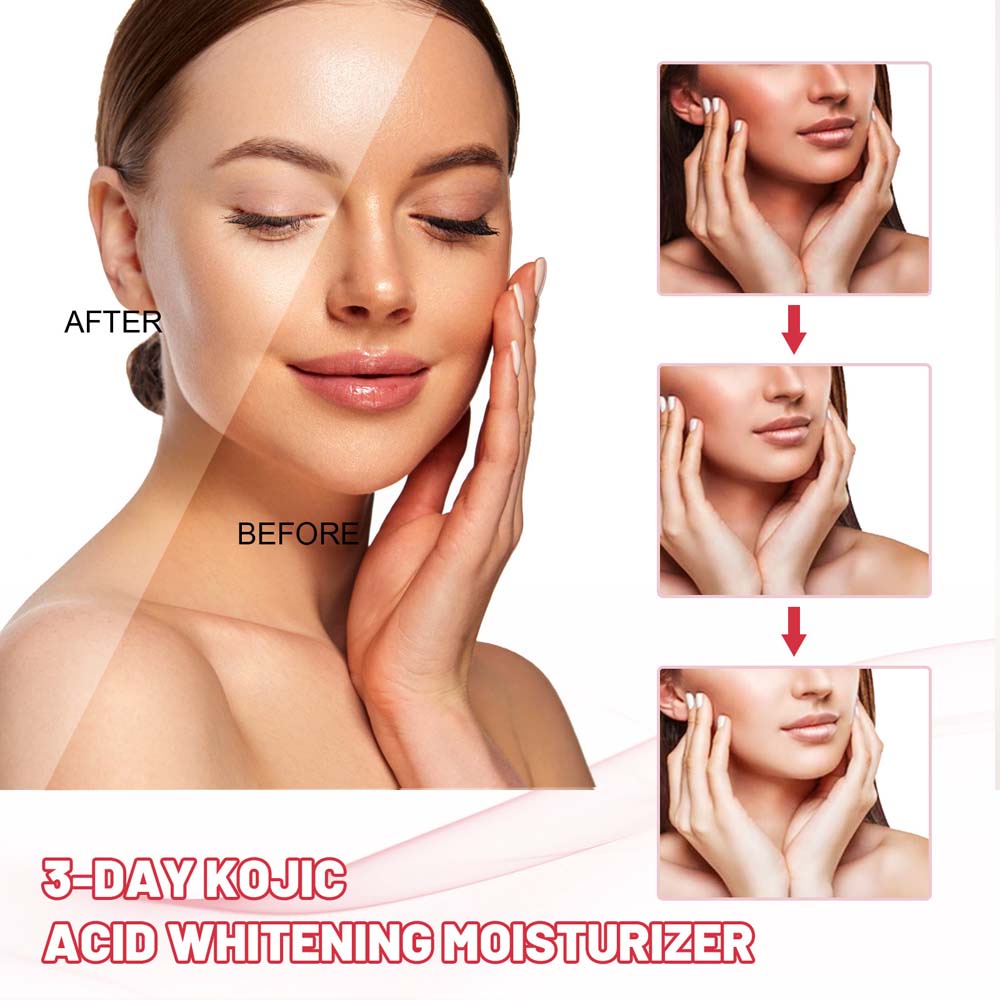 Eelhoe 3 Days Kojic Acid Whitening Moisturizing Cream Black Spot Repairing Cream Body Cream Removing Black Spots Depigmentation Brightening Moisturizing 25g