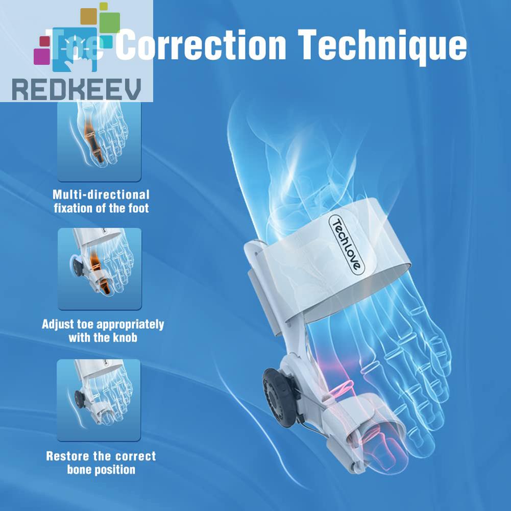 Dụng Cụ Nẹp Điều Chỉnh Tư Thế Ngón Chân Cái Bunion