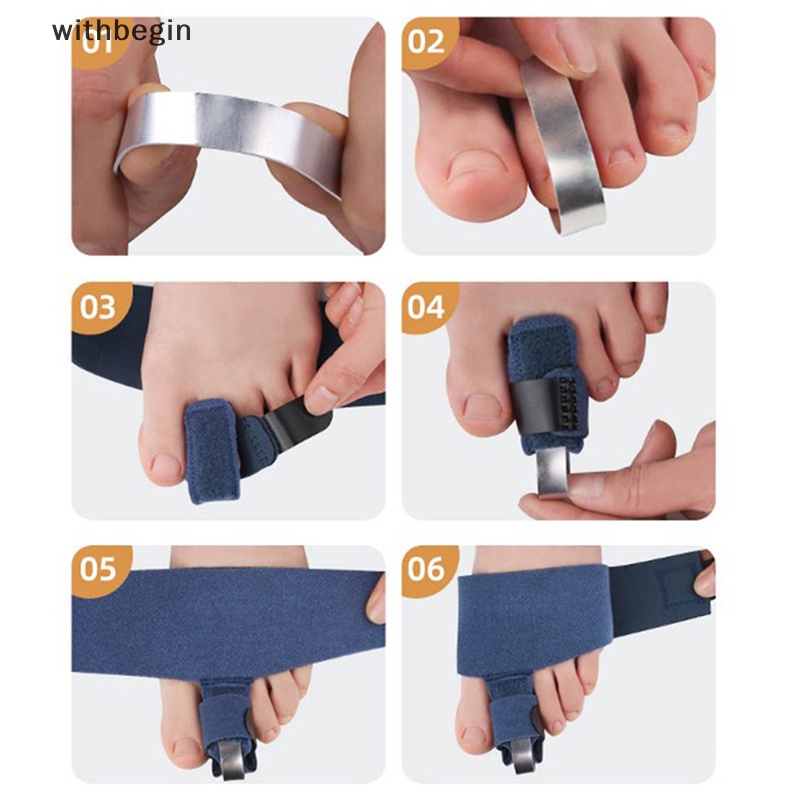 1 Dụng Cụ Nẹp Điều Chỉnh Ngón Chân Cái Giảm Đau Ease Valgus