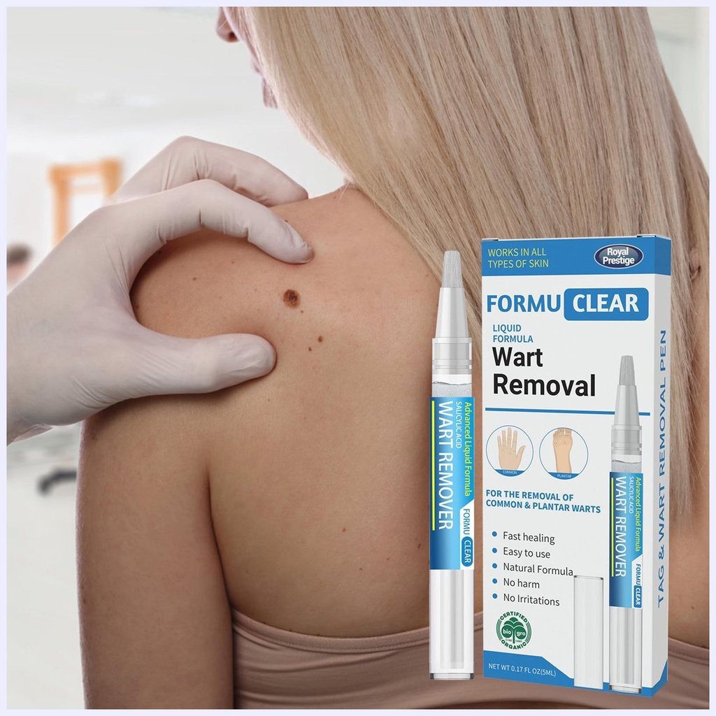 Bút Xóa Nốt Ruồi Và Mụn Thịt Dư Thông Dụng