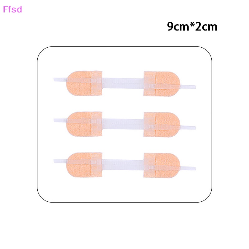 {Ffsd} Miếng Vá Vết Thương Khóa Kéo Tĩnh Điện Nhanh Chóng * Bán Chạy