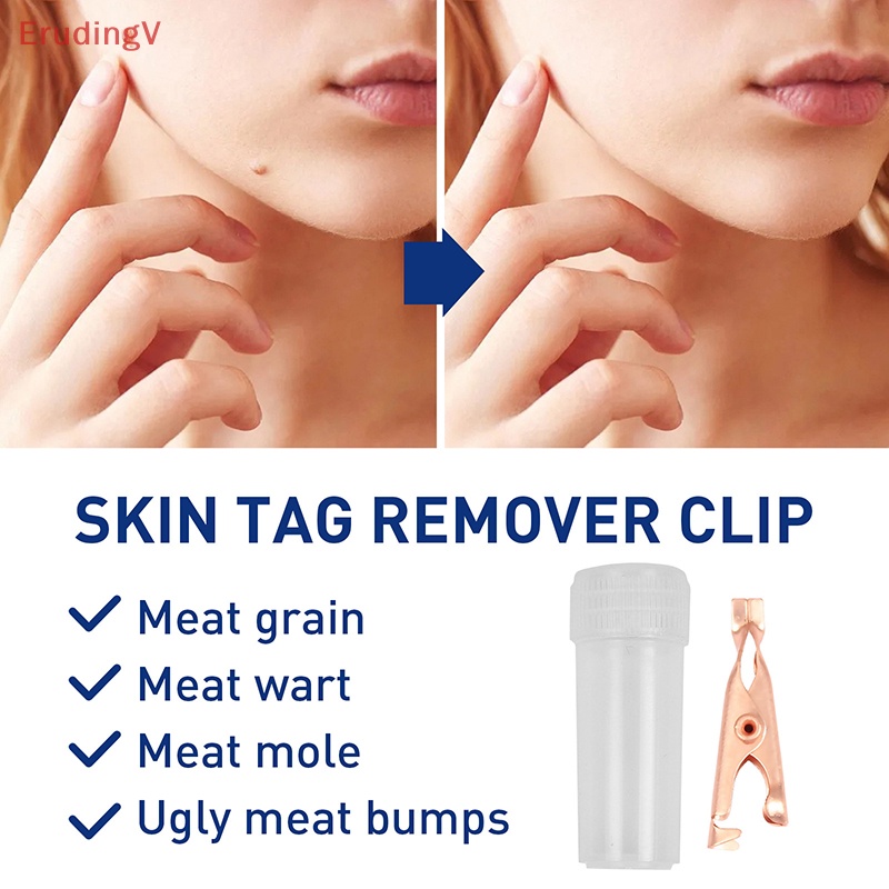 1 Dụng Cụ Kẹp Nhỏ Bằng Đồng Loại Bỏ Mụn Thịt Xăm Hình