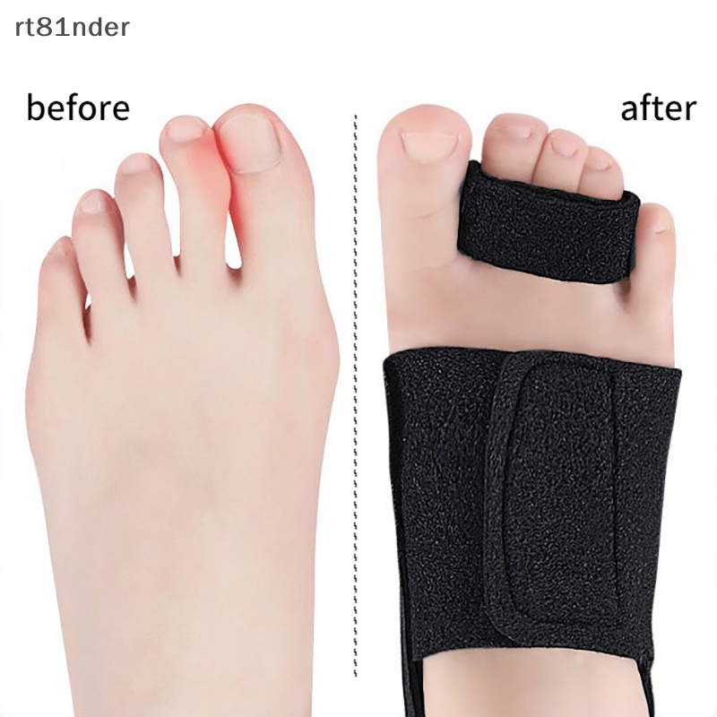 1 Đai Đeo Ngón Chân Chống Trượt Bảo Vệ Cho Hallux Valgus Overlapping n