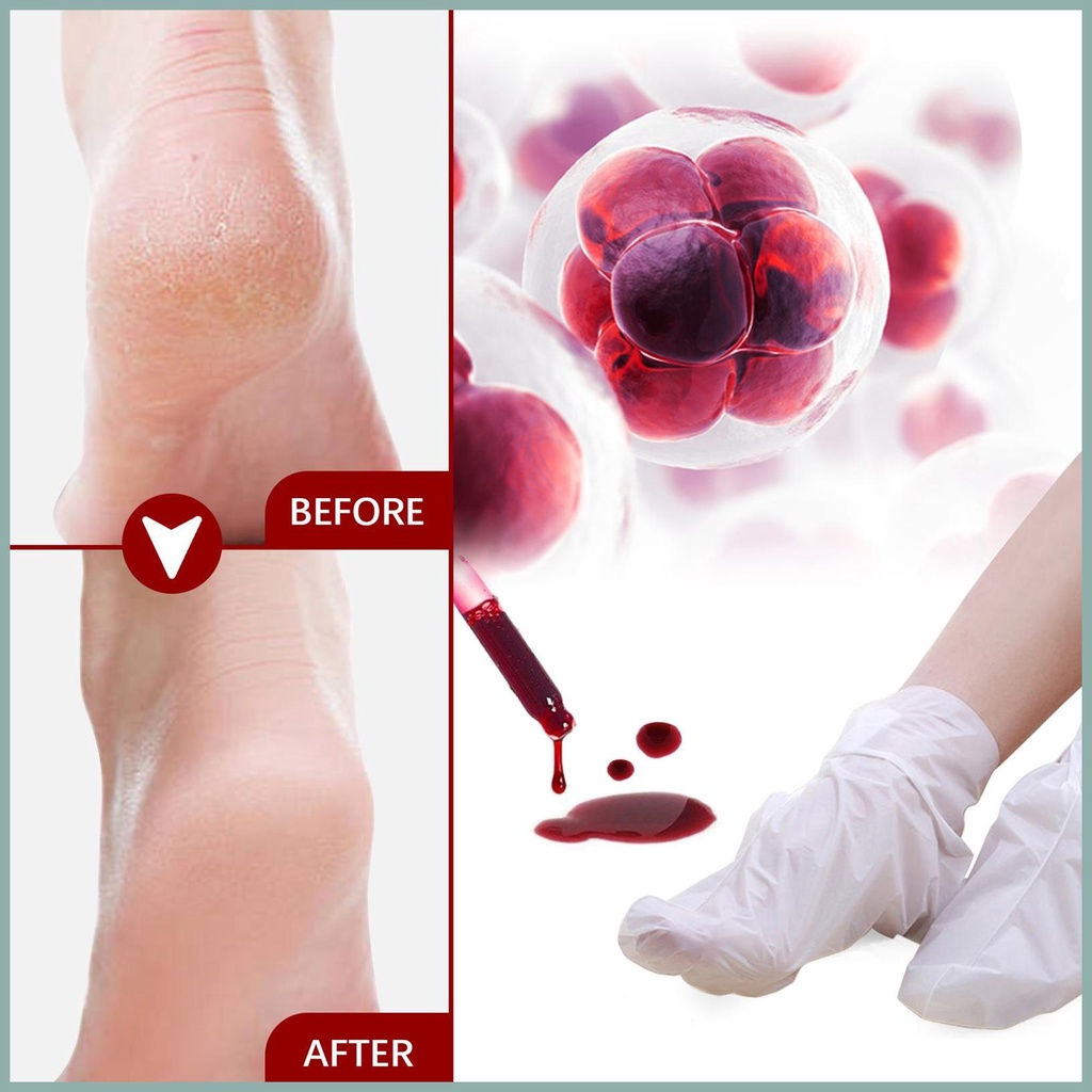 Vớ tẩy tế bào chết 1 cái / 5 cái mặt nạ lột chân sửa chữa gót chân thô loại bỏ da khô và cứng cho vết chai & yunvn yunvn