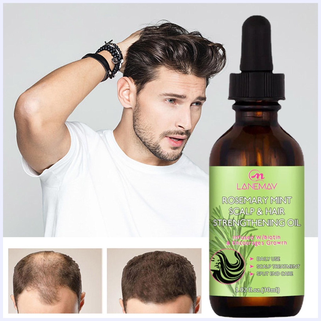 Dầu hương thảo cho tóc Dầu hương thảo hữu cơ cho da đầu & tóc chắc khỏe 1 Fl. Oz Rosemary Oil With Biotin & Essential Oils, Tinh dầu dưỡng cho tóc chẻ ngọn và da đầu khô