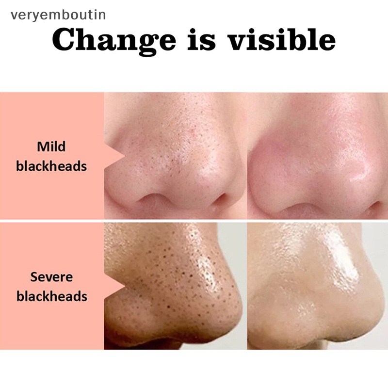 Hộp 20 Miếng Dán Mũi Lột Mụn Đầu Đen Làm Sạch Sâu Lỗ Chân Lông