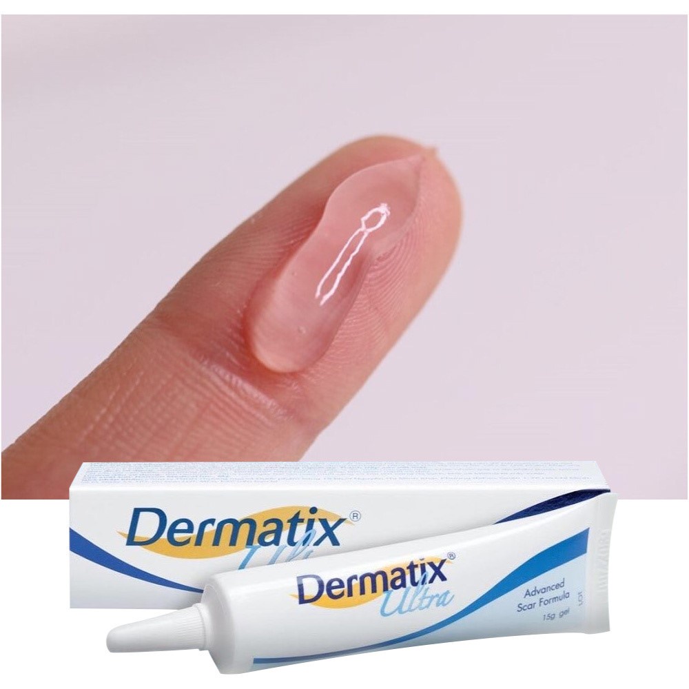 Dermatix Ultra 15g, Gel Trị Sẹo Dermatix Chính Hãng, Kem Giảm Sẹo Dermatik, Sẹo Dermatic Acnes KKDURANT
