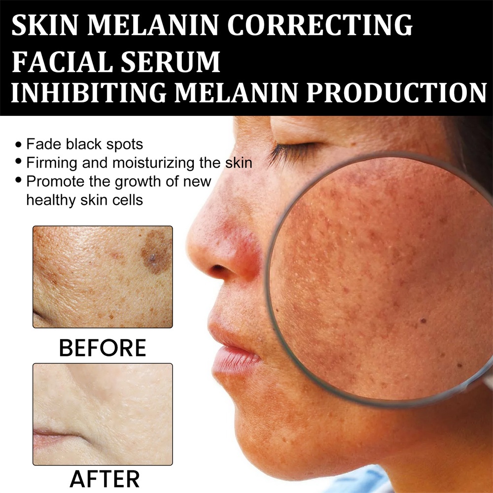 Serum điều chỉnh sắc tố da mặt JULYSTAR giảm vết thâm hàng ngày