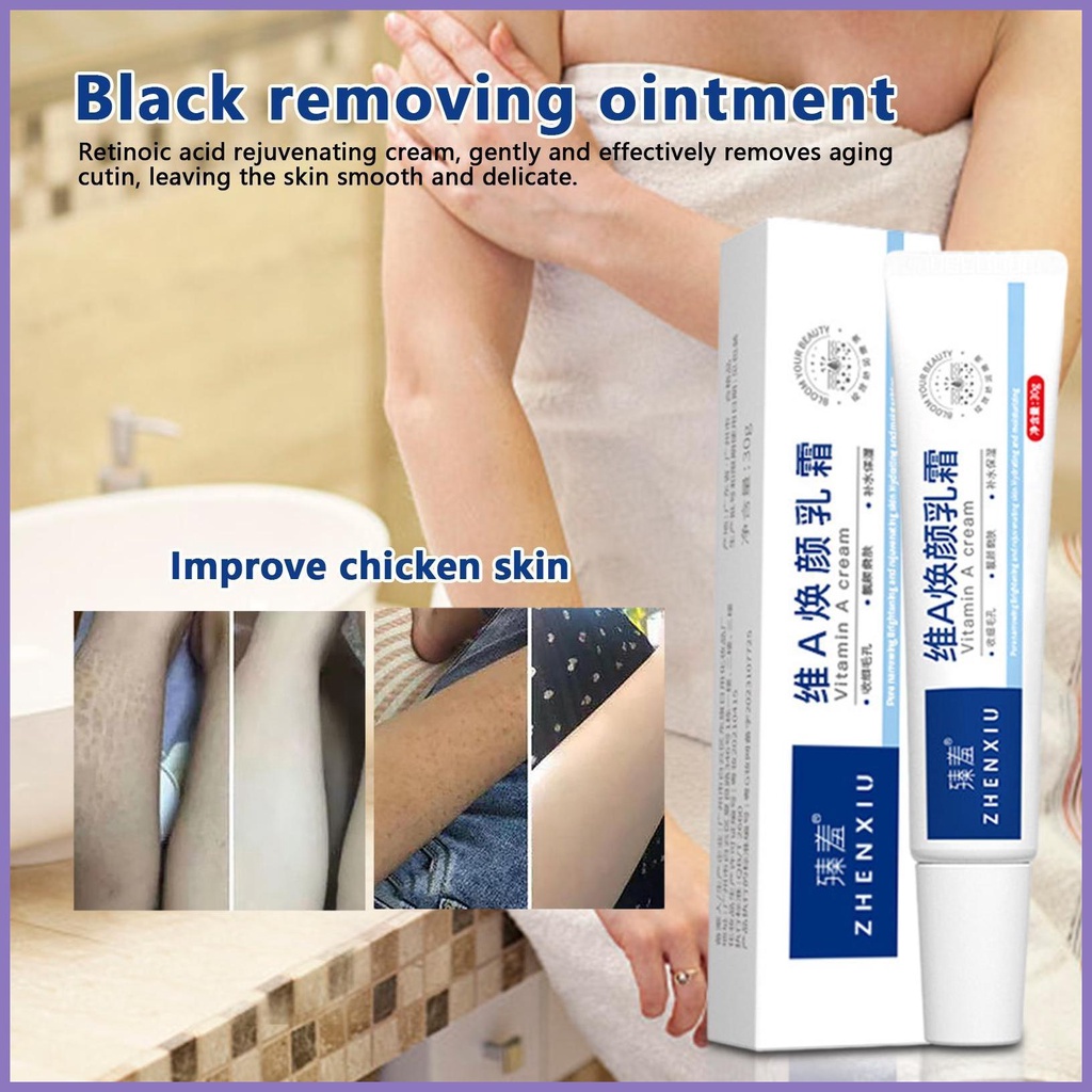 Kem Vitamin A Làm Sáng Da Loại Bỏ Mụn Đầu Đen Trẻ Hóa Và Dưỡng Ẩm nota2vn