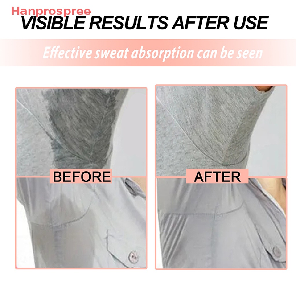 Bộ 20 Miếng Đệm Thấm Hút Mồ Hôi Vùng Da Dưới Cánh Tay Hanprospree