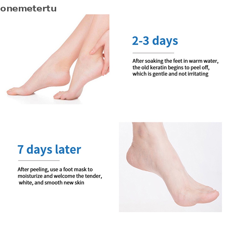 Mặt Nạ Chân Dưỡng Ẩm Tẩy Tế Bào Chết Chống Nứt Nẻ onemetertu