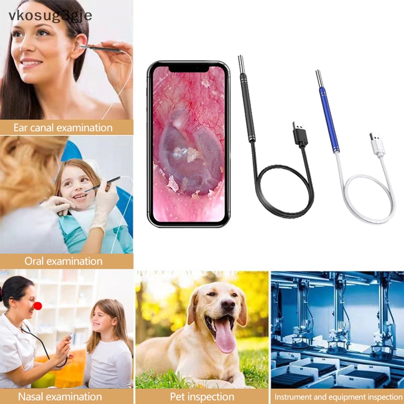 1 Bộ Dụng Cụ Lấy Ráy Tai Thông Minh Có Camera
