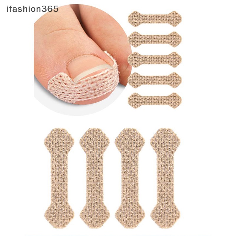 Set 4 / 10 Miếng Dán Chỉnh Hình Móng Chân Mọc Ngược ifashion365